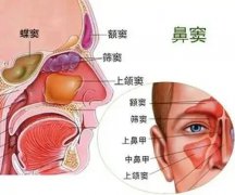 【全國(guó)愛(ài)鼻日】孩子出現(xiàn)這些癥狀，警惕鼻竇炎！ 