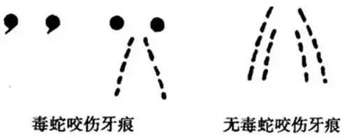 被蛇咬傷怎么辦？ 福德醫(yī)院教你毒蛇咬傷急救指南
